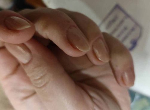 Лимонные ванночки для ногтей — разрекламированный трюк который не работает